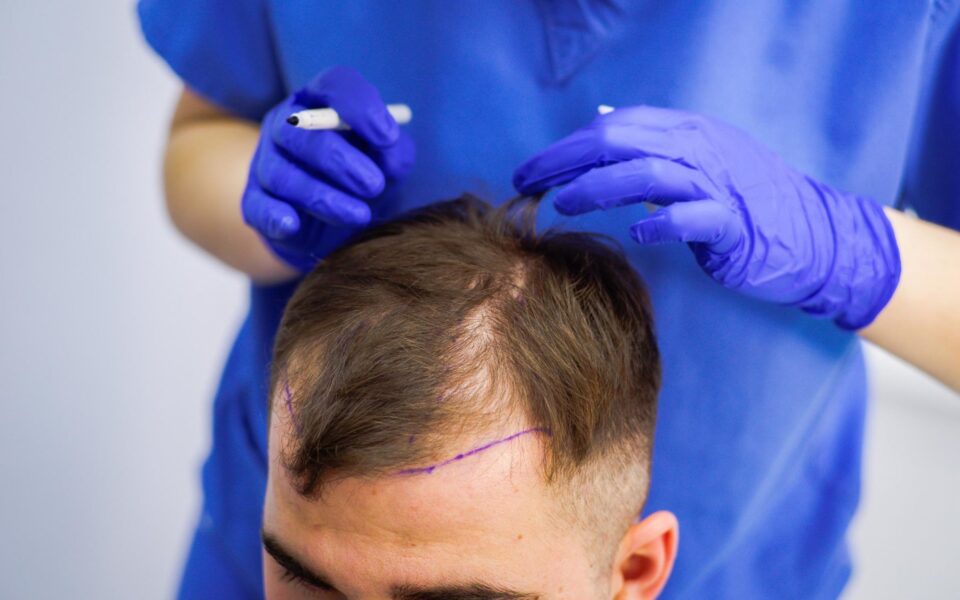 How Much Does a Hair Transplant in Dubai Cost? A Detailed Guide